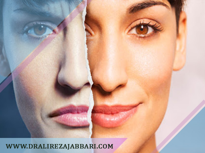 من اختلال دوقطبی دارم