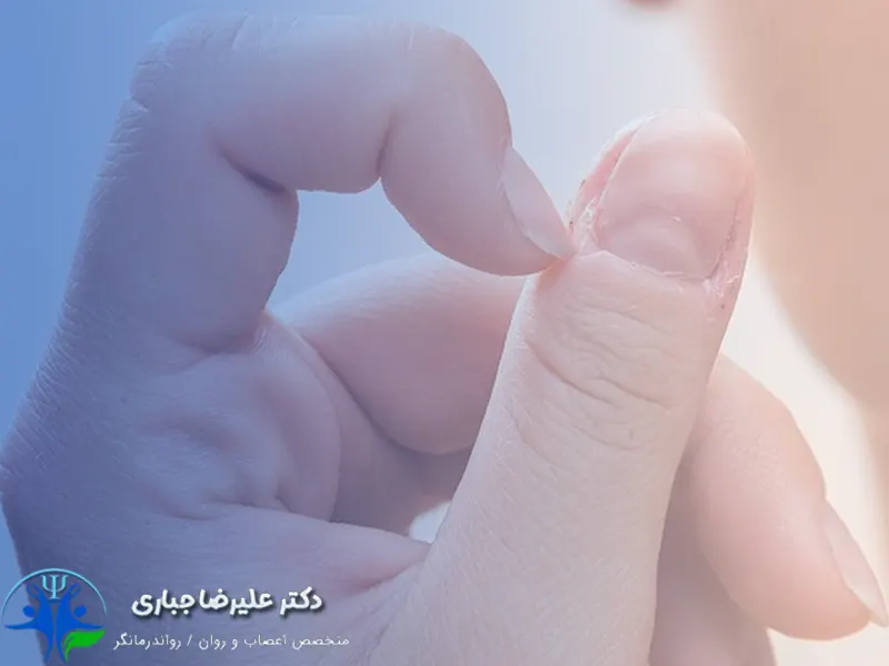درماتیلومانیا یا کندن پوست